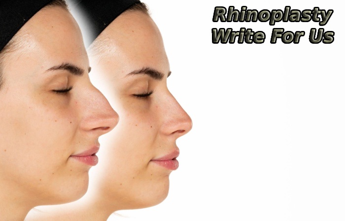 Rhinoplasty Write For Us